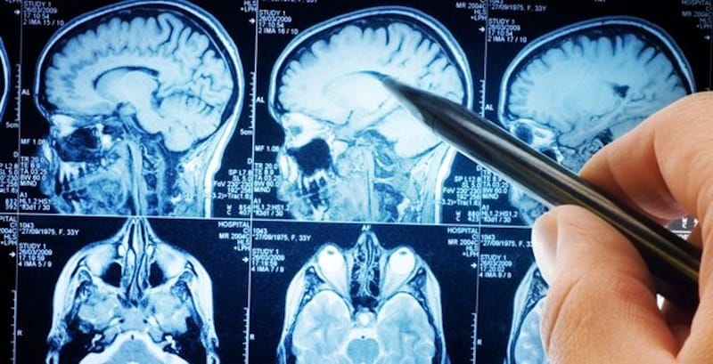 МРТ у Тернополі