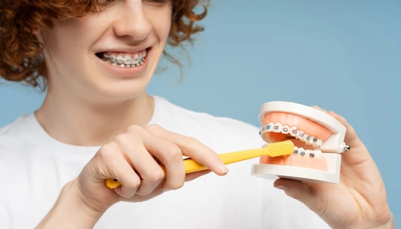 збереження цілісності брекетів